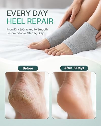 Moisturizing Gel Heel Socks for Cracked Feet, 2 Pairs