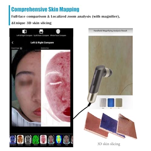 M17 Professional Skin Analysis Machine - 10-Spectrum Facial Scanner
