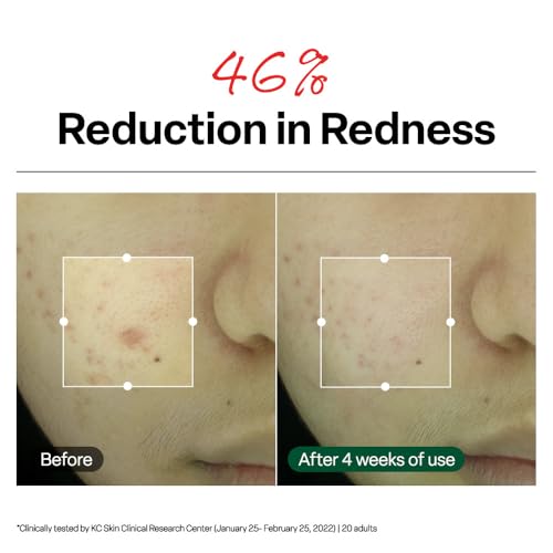 Dr. G R.E.D. Blemish Clear Soothing Cream 2.36 oz