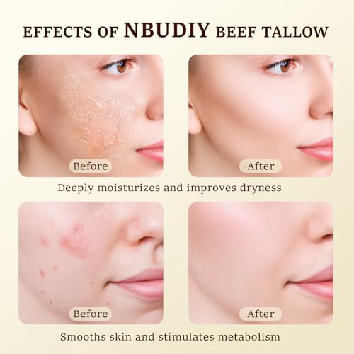 Beef Tallow for Skin, Tallow and Honey Balm, Tallow Face Moisturizer, Grass Fed Beef Tallow for Face - Sensitive Dry Skin Repair, Deeply Nourishing, Fragrance Free, Floral Mist