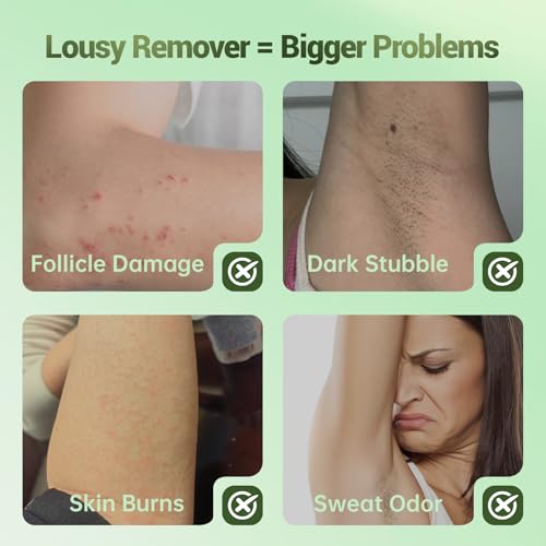 Hair Removal Cream For Women - Painless Body Hair Remover Sensitive Skin Hair Removal For Back Legs Fast And Gentle 6.76 Fl Oz