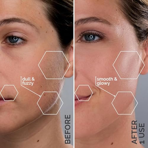 SPA SCIENCES SIMA Dermaplaning Tool – Painless Facial Exfoliation & Hair Removal