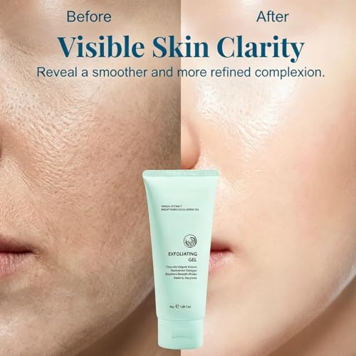 Herbal Exfoliating Gel - Gentle Pore Cleanser for All Skin