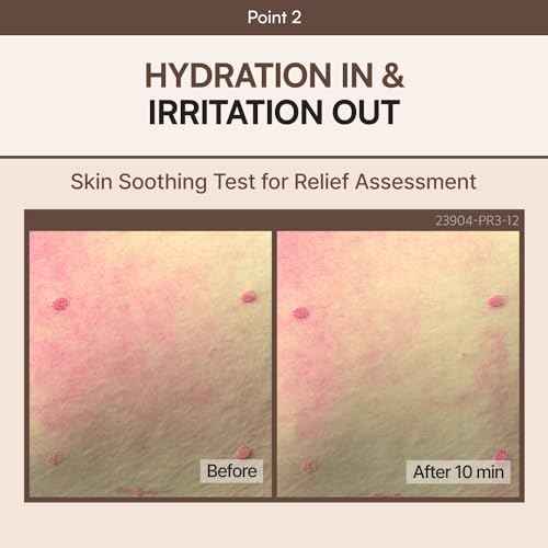 FLASKIN Milky Lotion | Soymilk Relief Protein Lotion | Skin Barrier Support, Hydration, Glow, Brightening | OAT and SOYBEAN EXTRACT, Niacinamide | Dry, Flaky Skin | Korean Skincare | 5.07 fl.oz.