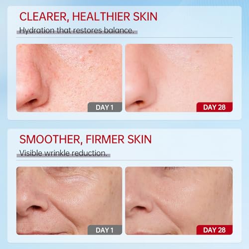 VGO 3 Pack 92% Snail Mucin Moisturizer, Anti Aging, Skin Repair & Hydrating Face Cream with Ceramide & Vitamin E