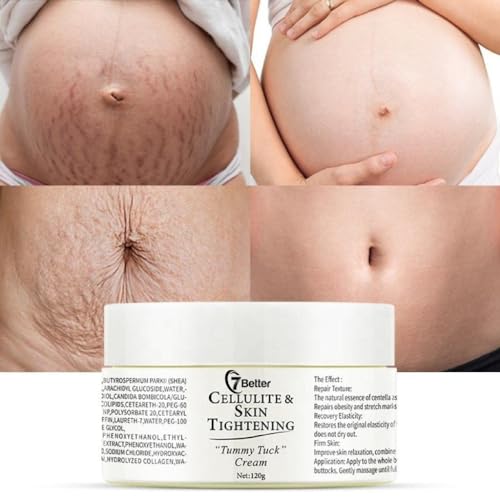 Pregnancy Stretch Mark & Scar Removal Cream
