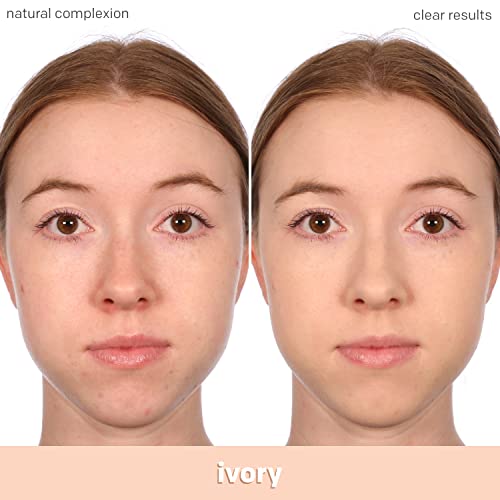 Almay Clear Complexion Acne Foundation Makeup with Salicylic Acid - Lightweight, Medium Coverage, Hypoallergenic-Fragrance Free, for Sensitive Skin , 100 Ivory, 1 fl oz.