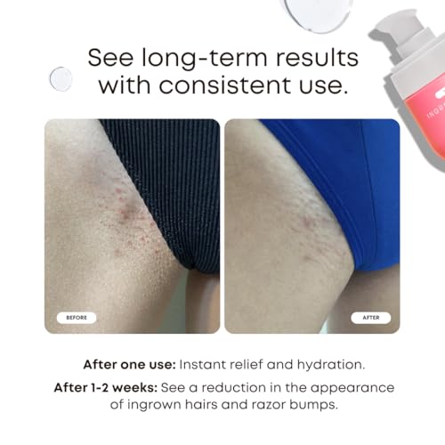 Bushbalm Ingrown Hair 2-Step Routine Kit - Oil & Scrub