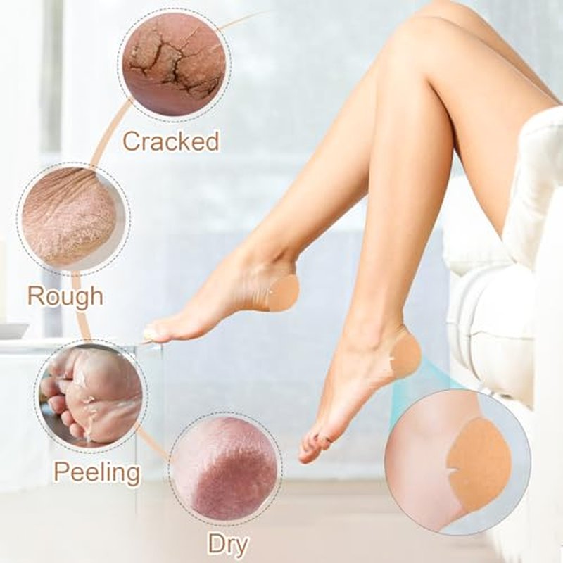 TEAWOO Cracked Heel Treatment Patches - 30 Pack Repair Bandages