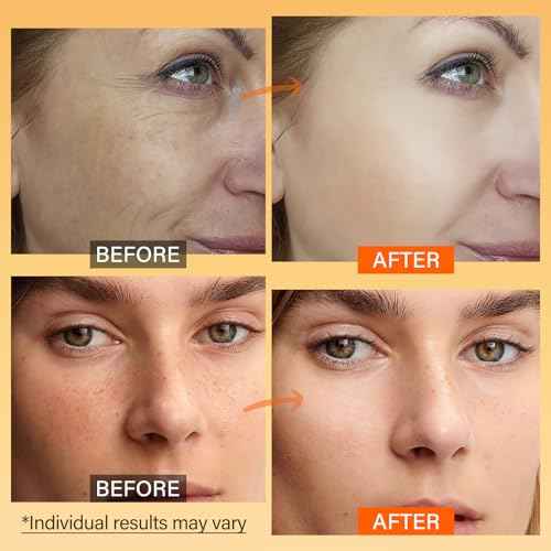 Vitamin C Face Moisturizer, Brightening & Anti-aging Face Cream with Turmeric for Dark Spots, Wrinkles & Uneven Tone, Glowing Skin Care Hydrating with Niacinamide & Squalane for All Skin Types, 2.3 Oz