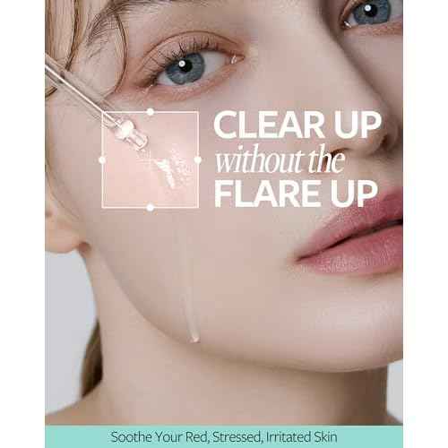 RECIPE Azelaic Acid 10 Soothing Ampoule - Soothing Serum, Facial Serum for Sensitive skin - Korean Skincare for Mild Breakouts (1.01 fl oz)