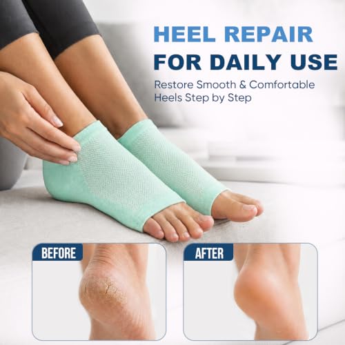 Moisturizing Gel Heel Socks - 2 Pairs for Cracked Feet