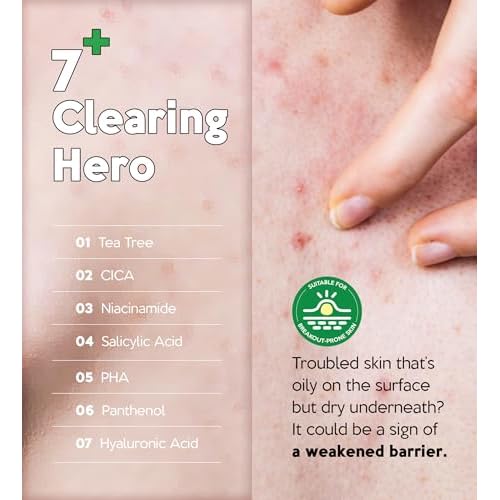 Troubless CLEAR 7 Plus Pure Moisture Body Lotion - Hydrating Body Moisturizer for Troubled Sensitive Skin w/ 7 Skincare Ingredients Gentle, Calming & Non Greasy Body Cream for Women & Men (16.9 fl oz)