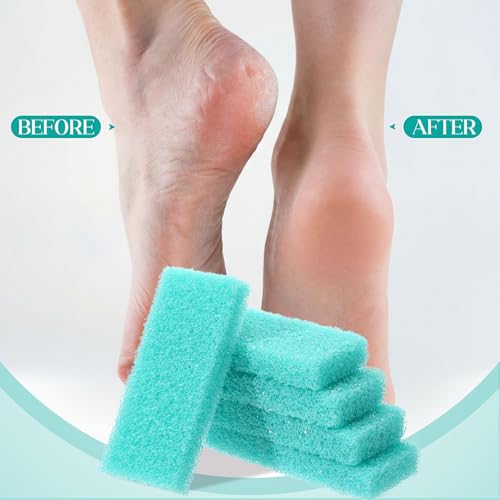 Pumice Stone Bulk 300 Pack - Foot Scrubber Callus Remover for Feet (Cyan)