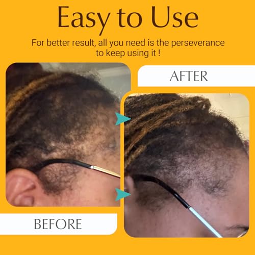 Hair Growth Comb