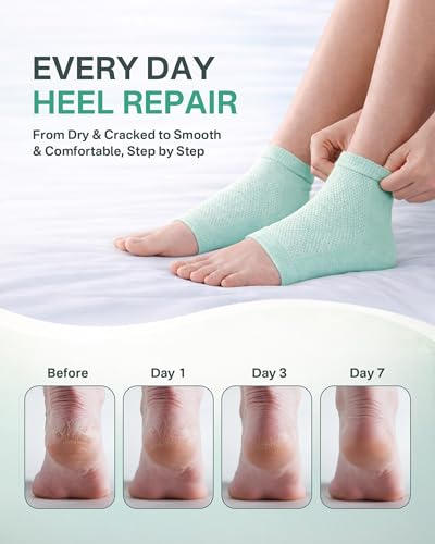 Moisturizing Cotton Socks for Cracked Heels - 2 Pairs