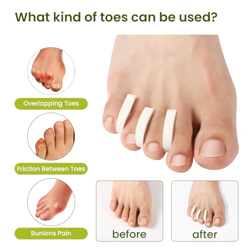 Bukihome Foam Toe Separators 44-Pack – Pain Relief & Comfort