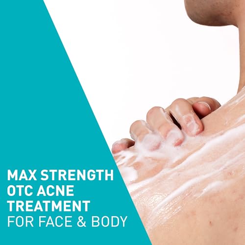 CeraVe Acne Foaming Cream Wash with 10% Benzoyl Peroxide