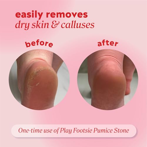 Onyx Professional Double Sided Siliglass Pumice Stone - 2 Pack Callus Remover