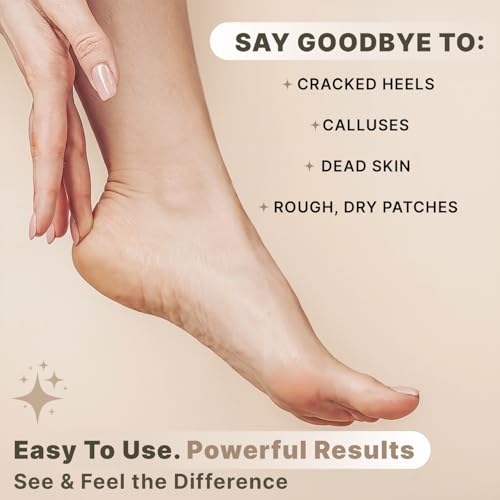 Beauty by Earth Natural Lava Pumice Stone for Feet - Callus & Dead Skin Remover