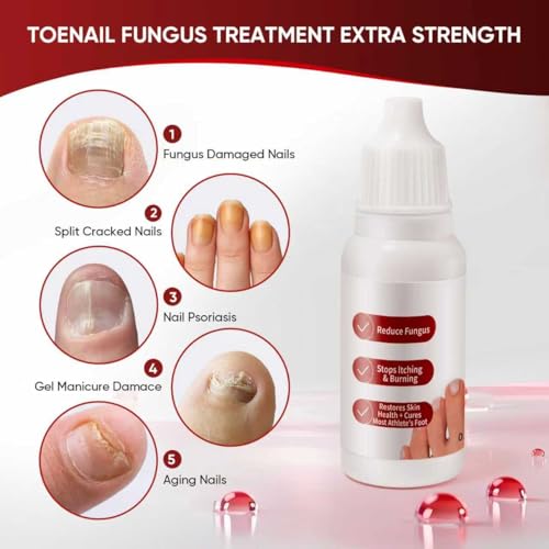 Toenail Treatment,Gentle Formula, Effectively Improves Nails for a