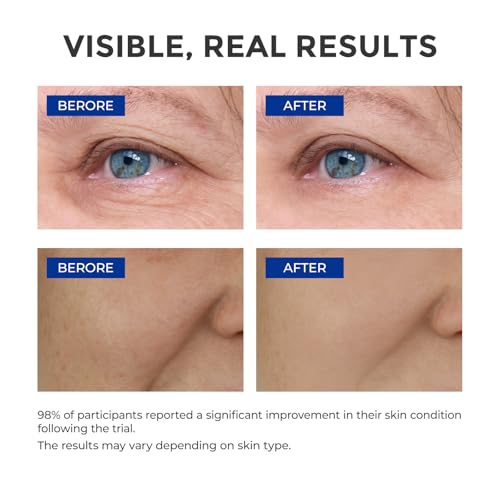 Nuvadermis Scar Treatment Set: AM Scar Gel + PM Intensive Scar Cream