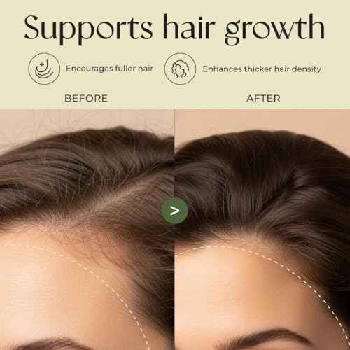 Gya Labs Rosemary & Castor Hair Oil - 4 Fl Oz - for Scalp Health, Strengthens & Protection from Damage