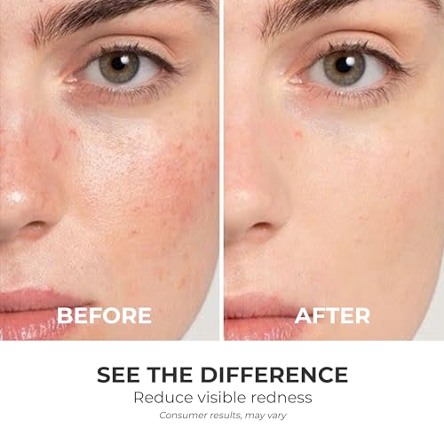 Triple Lipid-Peptide Cream: Enriched with Lipids, Peptides, Hyaluronic Acid, and Shea Butter for Brightening, Firming, and Plumping, 1.8 oz