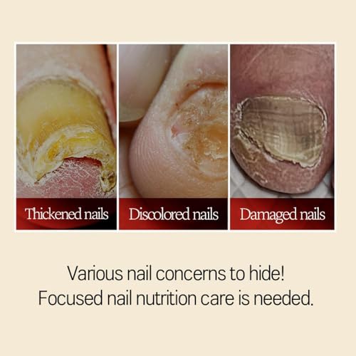 Nail Strengthener Serum with Keratin & Biotin - 17ml