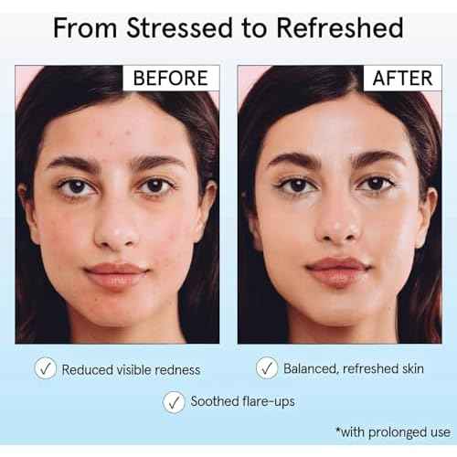 grace & stella Hypochlorous Acid Spray for Face - Body Acne Spray - Gentle Face Mist to Calm Redness & Flare-Ups Back Acne - Soothing Facial Mist for Sensitive Skin - Travel Size (60 ml/2 fl oz)