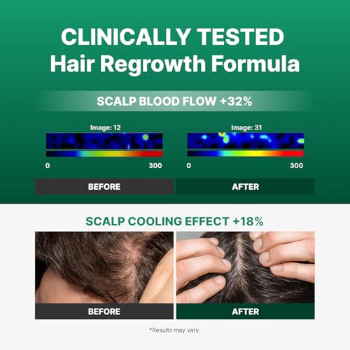 Microneedling Hair Growth Serum with Exosomes & Peppermint Oil - 0.5 fl oz