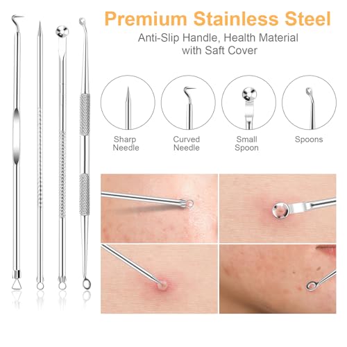 UUBAAR Blackhead Remover Kit, 9 Pimple Popper Tools with Tweezers