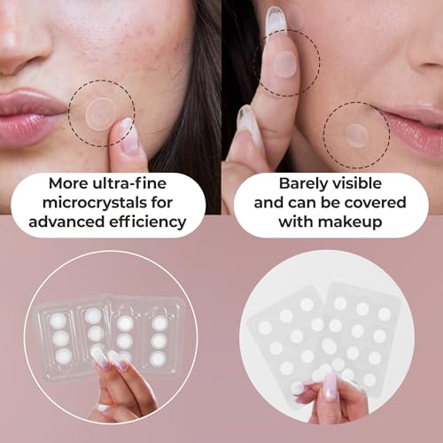 OMMA 72 Patches Pimple Patches for Face and 18 Micropoint Acne Patch Bundle