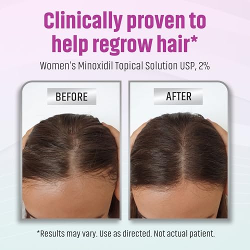 Minoxidil 2% Hair Regrowth Solution for Women | 2 Fl Oz
