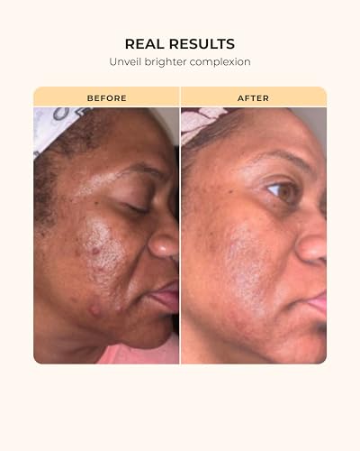 Buttah Skin 3-Piece Skincare Kit | Cleanser, Vitamin C Serum & CocoShea Moisturizer