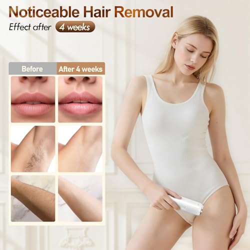 IPL Hair Removal Device with Sapphire Ice Cooling System - White