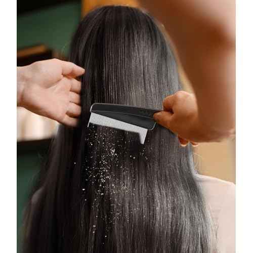 Dandruff Comb Fine Tooth Scalp Detox Comb Lice for Women, Men & Kids Stainless Steel Scalp Detoxing, Sweep & Massage Hair Brush Tool for Hair Care (Black 1PC)