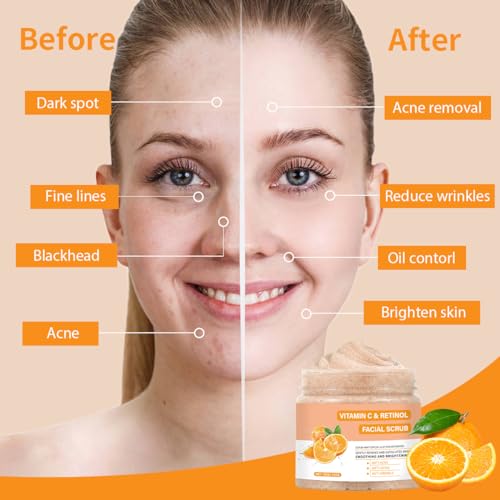 Vitamin C Face Scrub with Retinol & Exfoliating Beads