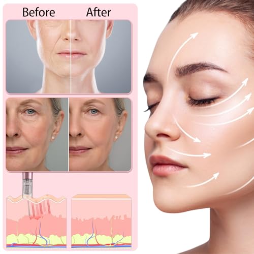 0.25mm Microneedle Derma Roller for Home Skin Care