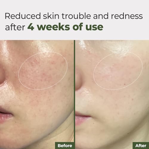 Daily Ampoule Pad (100 Pads) ? Korean Vegan Toner Pads for Soothing, Calming & Deep Hydration | for Dry, Stressed, and Sensitive Skin | Centella Asiatica & Panthenol | Korean Skincare
