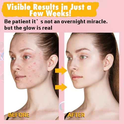 Lemon Turmeric Kojic Acid Soap Bar, Turmeric Soap Bar with Vitamin E for Dry Sensitive Skin, Lemon Soap for Face, Body Hands 2 Bars