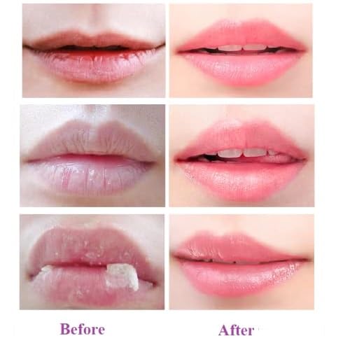 2 Pcs Honey Pot Lip Balm, Moisturizing Restors Moisture Bee Lip Mask for Dry Lips Lip Mask.(Honey)