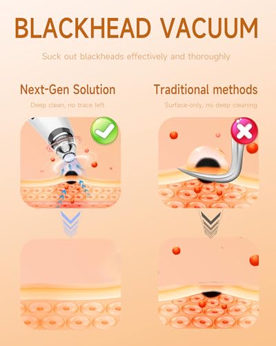 Blackhead Remover Vacuum Pore Cleaner with 6 Probes