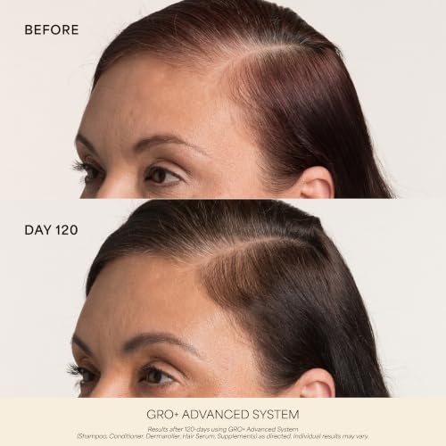VEGAMOUR GRO+ Advanced Dermaroller for Scalp Hair Growth