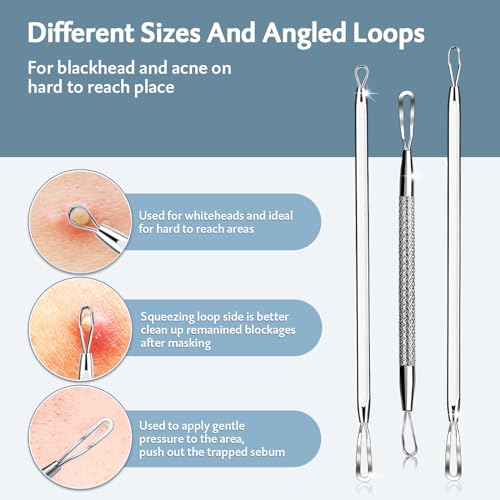 MENOLY 10-Piece Pimple Popper Tool Kit for Blackheads & Acne