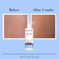 WishCare 10% AHA + 1% BHA Body Lotion for Men & Women - Body lotion for dry skin - Detans, Smooths Rough & Bumpy Skin 200ml