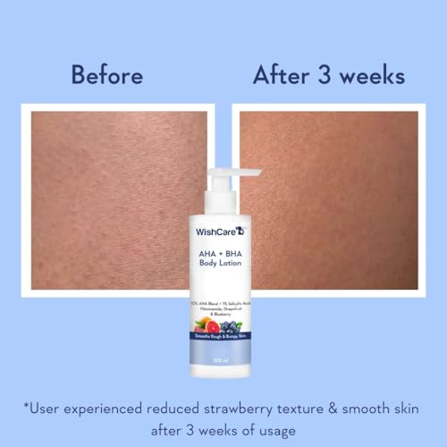WishCare 10% AHA + 1% BHA Body Lotion for Men & Women - Body lotion for dry skin - Detans, Smooths Rough & Bumpy Skin 200ml