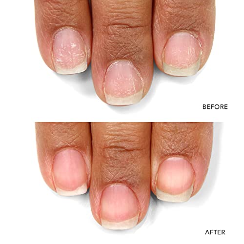 LONDONTOWN Kur Nail Probiotic Instant Boost Mask