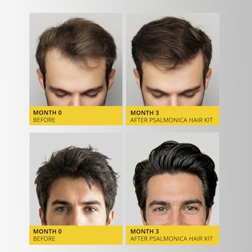 Psalmonica Hair Growth Shampoo & Conditioner Set 9.5 Fl Oz (Pack of 2) for Thinning Hair
