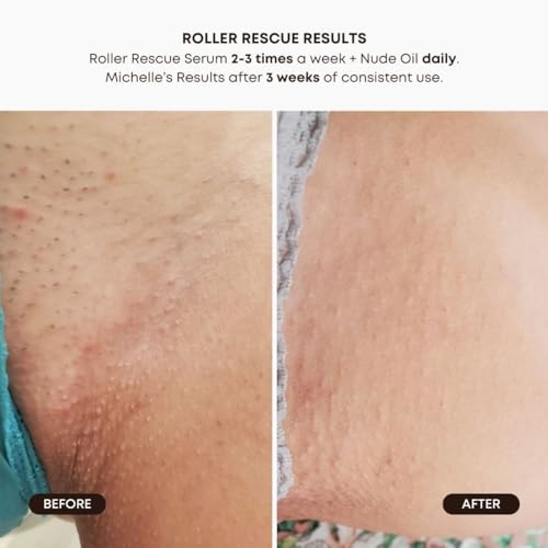 Bushbalm Ingrown Hair Trio Bundle - Roller, Oil & Scrub
